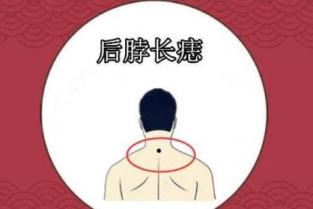 风水上后脑勺长痣代表什么意思