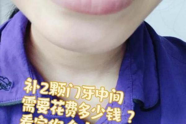 八字型门牙