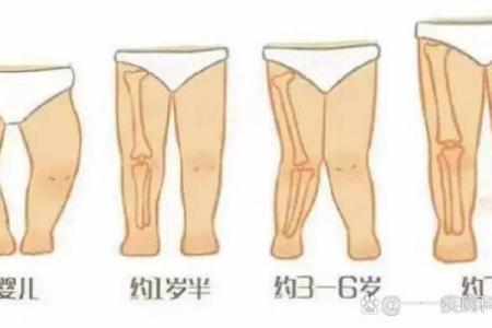 内八字脚