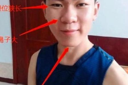印堂痣和观音痣的区别,观音痣是大富大贵的代表