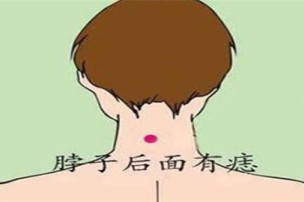 脖子上不同位置胎记算命