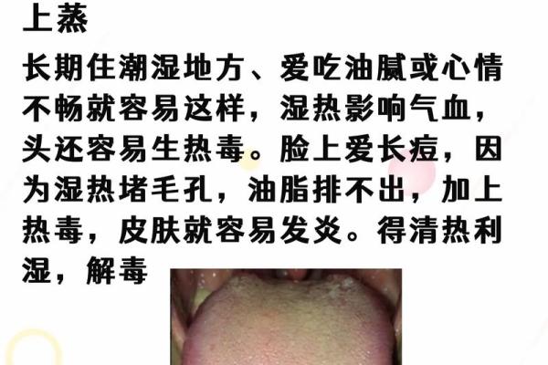 寒湿八字