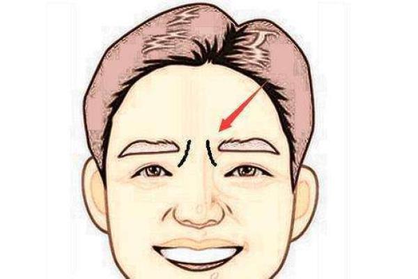 印堂八字纹的男人财运好吗