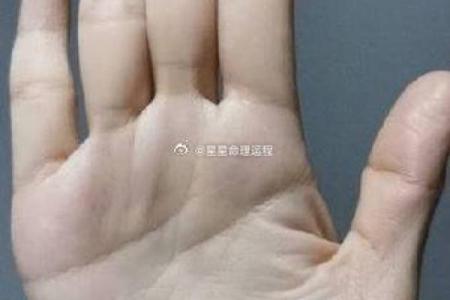 算命的说，手腕上有这样的纹路，一定会破财！