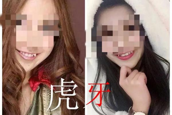 虎牙算命：面相虎牙分析