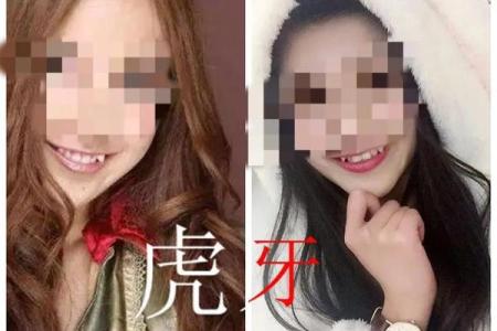 虎牙算命：面相虎牙分析