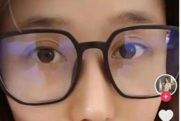 眼睛黑眼珠子多算命 眼睛黑眼珠子多算命