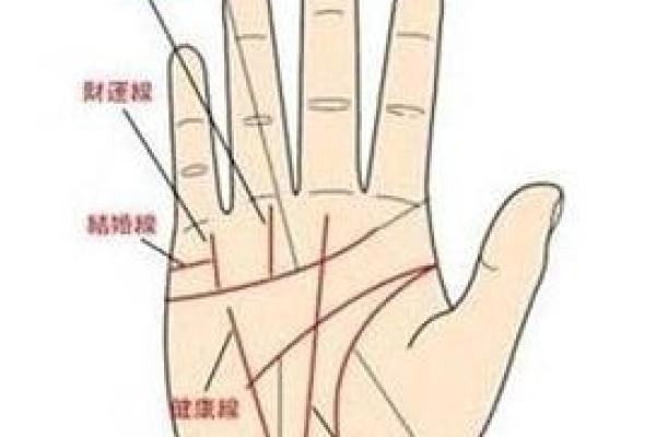 怎么看胎记算命-