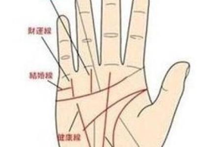 怎么看胎记算命-