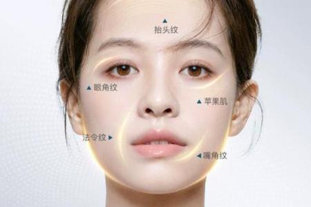 眉间八字纹消除