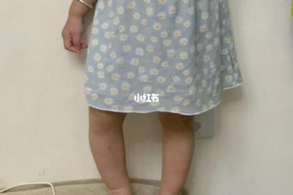 婴儿八字腿 婴儿八字腿