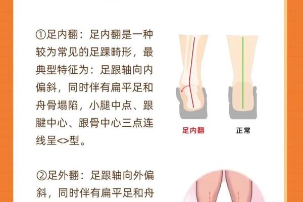 内八字、外八字孩子脚型正常不正常，家长可以这么判断