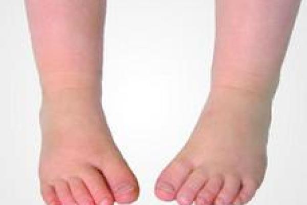 内八字反穿鞋 内八字反穿鞋