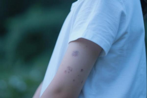 童子命的胎记及生辰八字如何查童子命