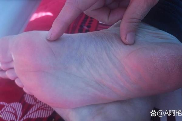 八字纹的女人是穷相吗? 八字纹的女人是穷相吗?