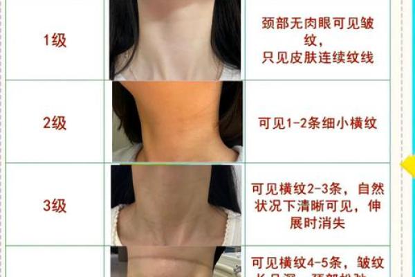 脖子上的胎记如何算命-
