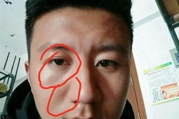 印堂八字纹,男人眉间有八字纹好不好 印堂八字纹,男人眉间有八字纹好不好