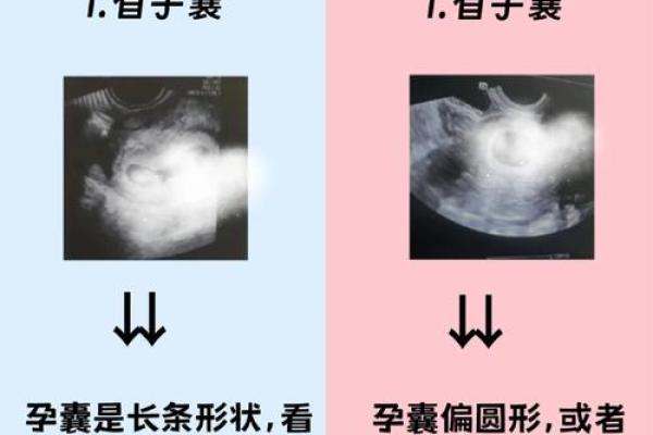 胎记算命图解好坏 胎记算命图解好坏