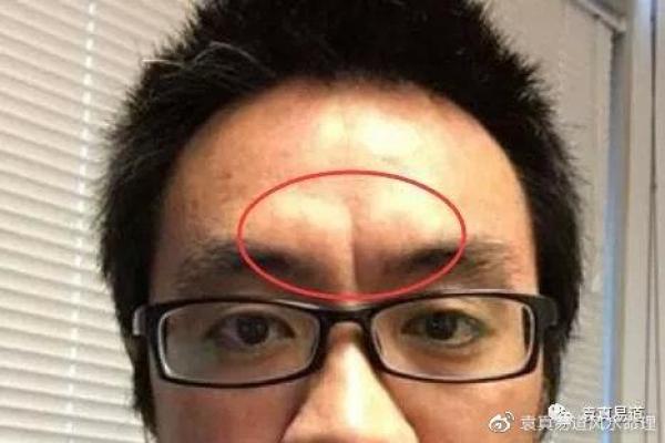 后脑勺有三条竖杠 后脑勺头皮三条竖纹算命 后脑勺有三条竖杠 后脑勺头皮三条竖纹算命