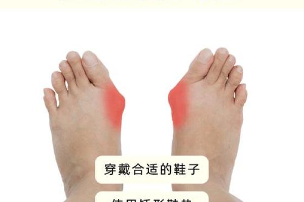 足脊健康知识小课堂(第三期) - 外八字篇 足脊健康知识小课堂(第三期) - 外八字篇